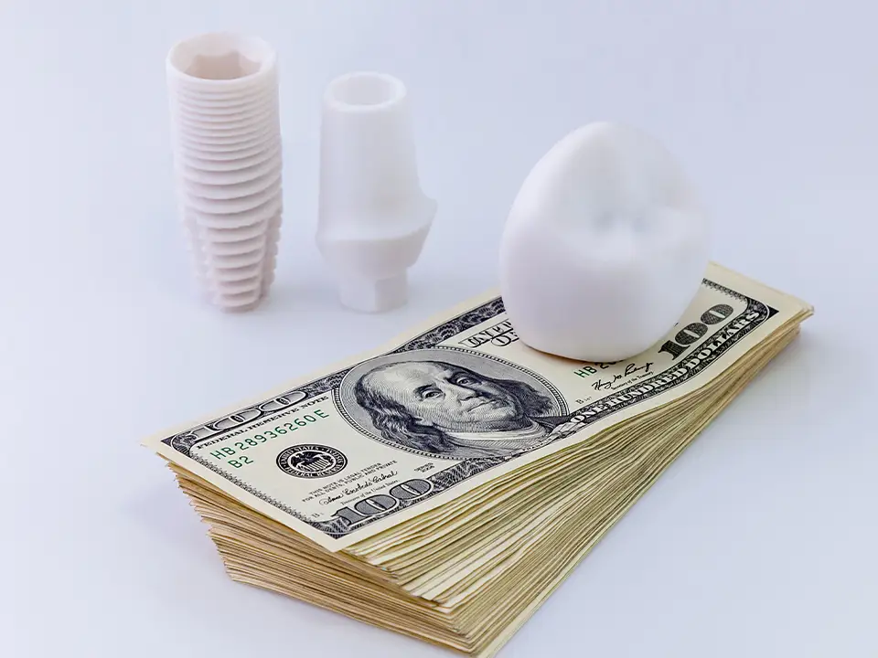 Dental Implant Scam