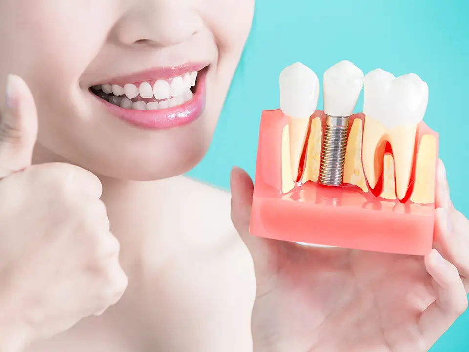 Low Cost Dental Implants