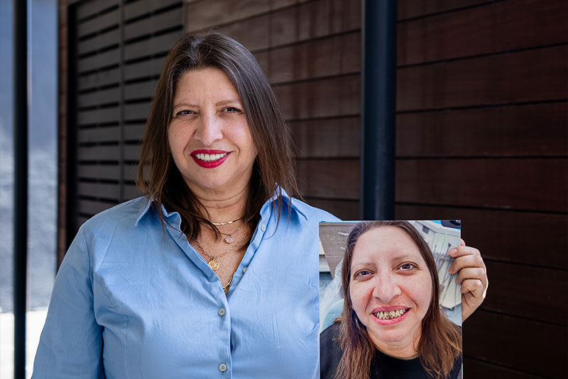 patient holding up before photo of their teeth