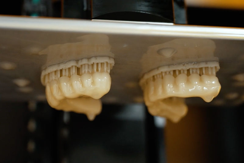 full archs being made in 3d printer