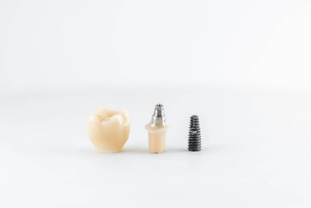 adhp fallbrook Managing a Broken Implant Screw