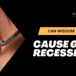 Can-Wisdom-Teeth-Cause-Gum-Recession american dental health providers