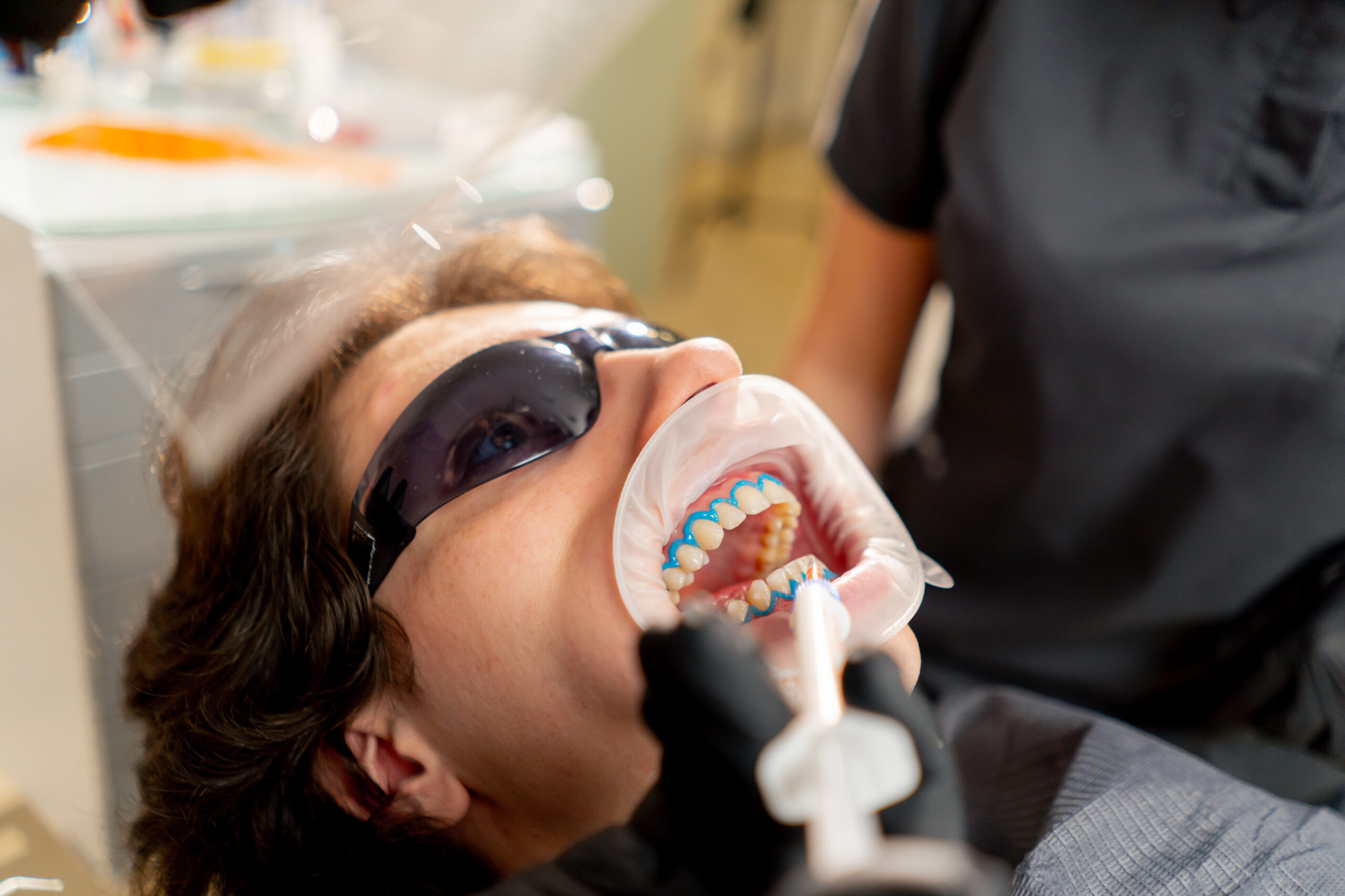 affordable-dental-health-providers-fallbrook-tartar-removal-scaled