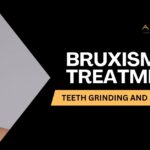 bruxism-treatment-solutions-dentist-torrance