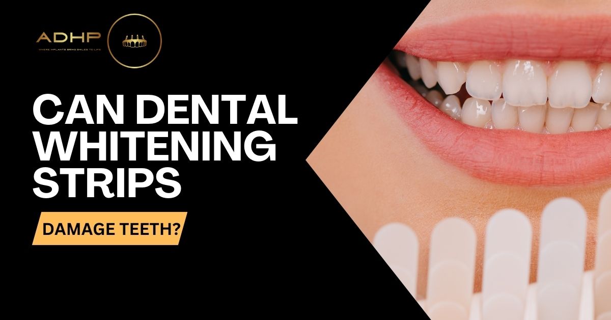 Can Dental Whitening Strips Damage Teeth?