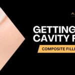 composite-dental-fillings-adhp-ca