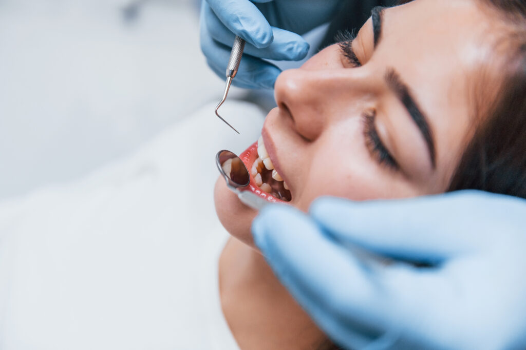 composite-dental-fillings-adhp-ca-dental-clinic