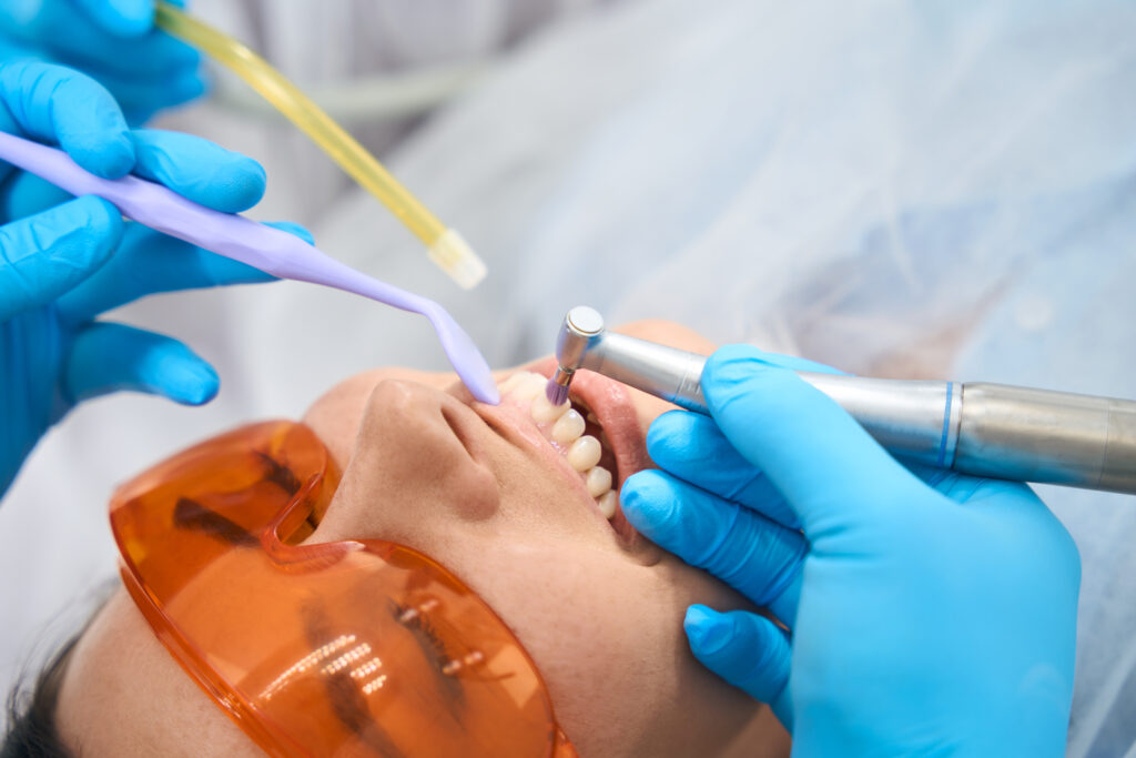 dental-clinic-ca-composite-dental-fillings-adhp