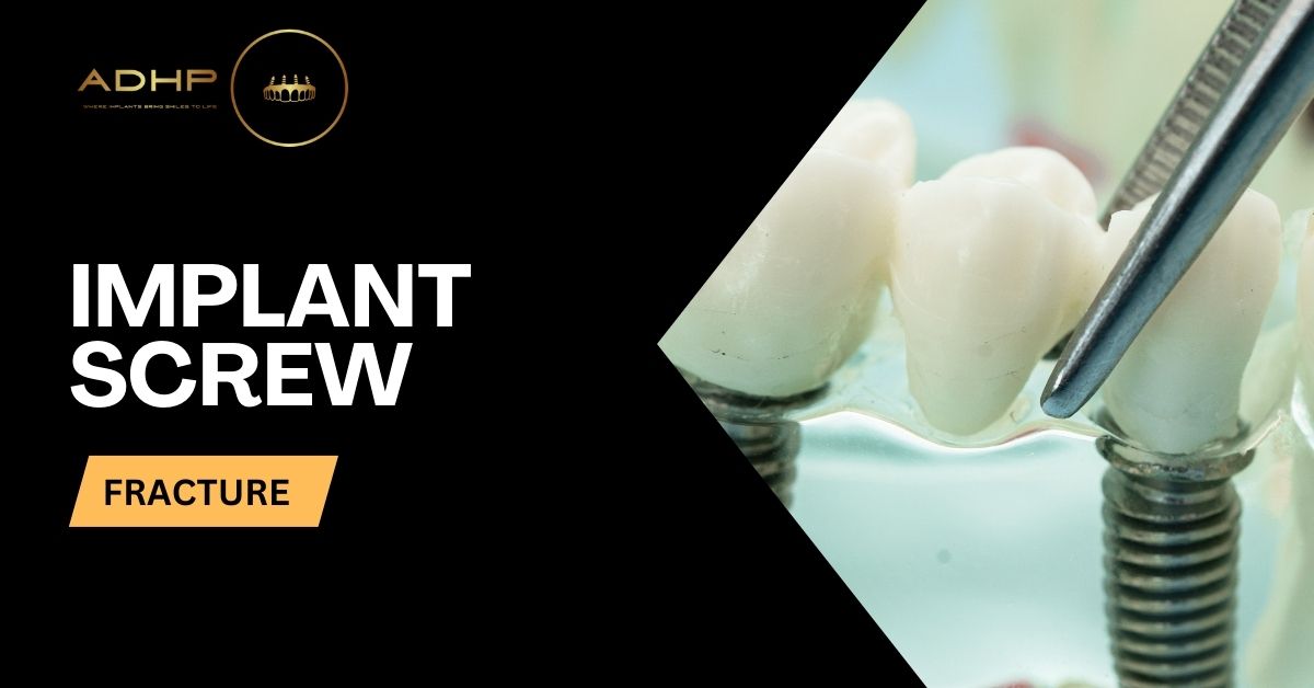 Implant Screw Fracture