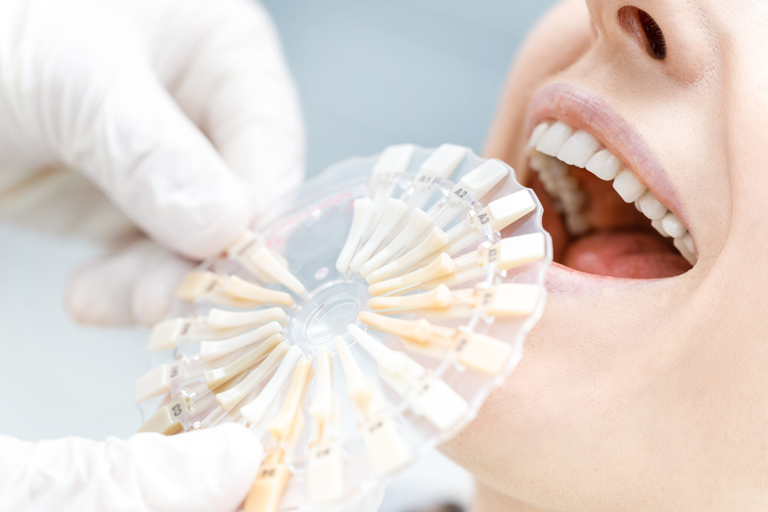ADHP Torrance Whitening-Dental-Implants-at-Home-scaled.jpg