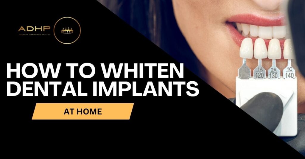 Torrance How to Whiten Dental Implants ADHP Dental clinic