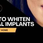 Torrance How to Whiten Dental Implants ADHP Dental clinic