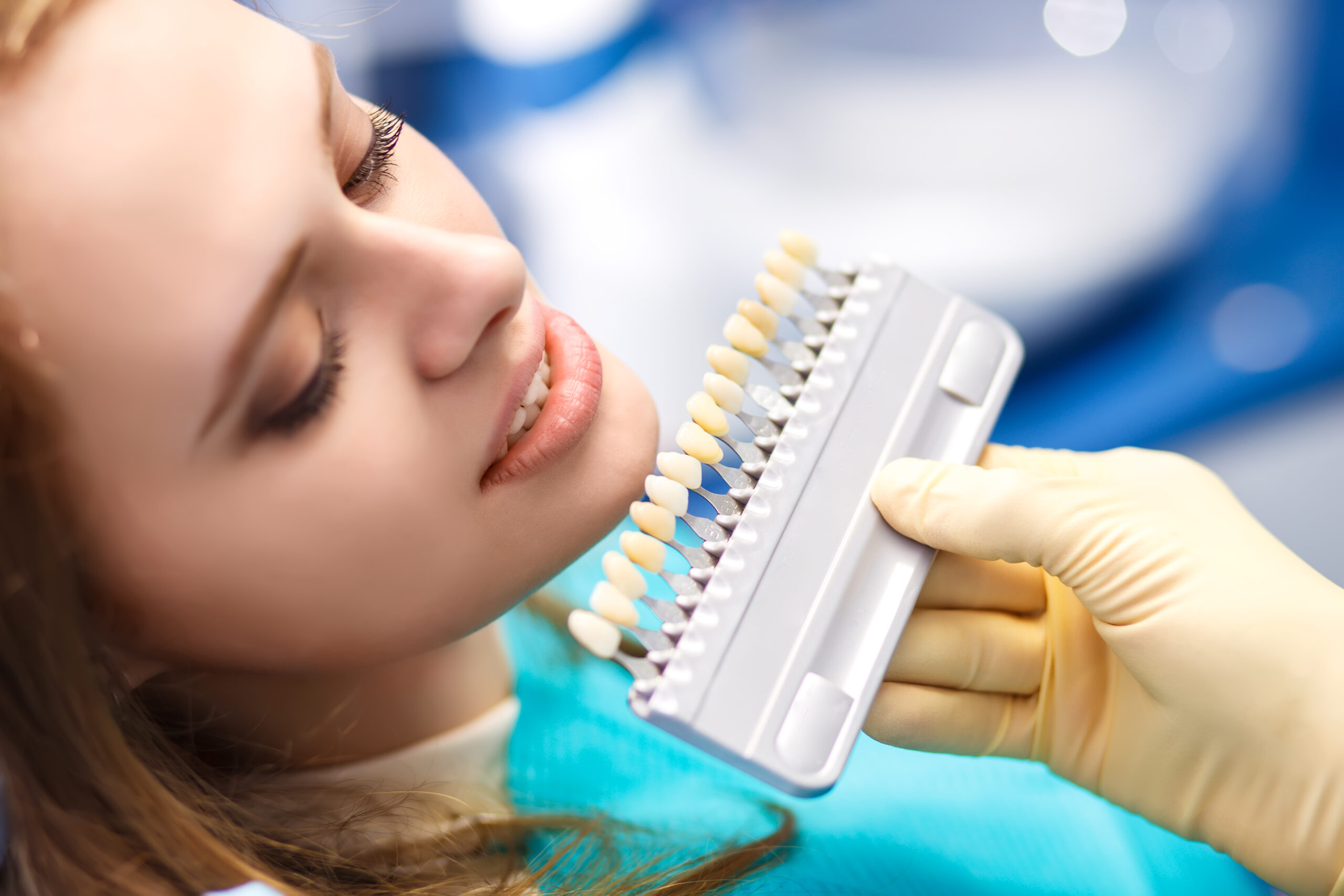 How-to-Whiten-Dental-Implants-at-Home-ADHP torrance