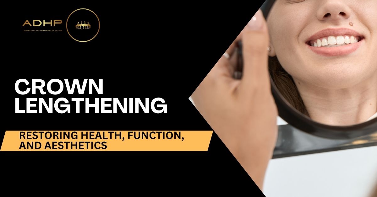 Crown Lengthening: Restoring Health, Function, and Aesthetics