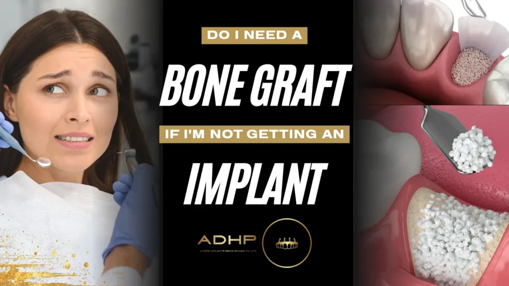 Do I Need a Bone Graft if I'm Not Getting an Implant? 