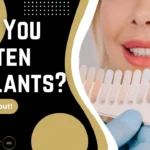 Can You Whiten Implants? Everything Torrance Patients Need to Know