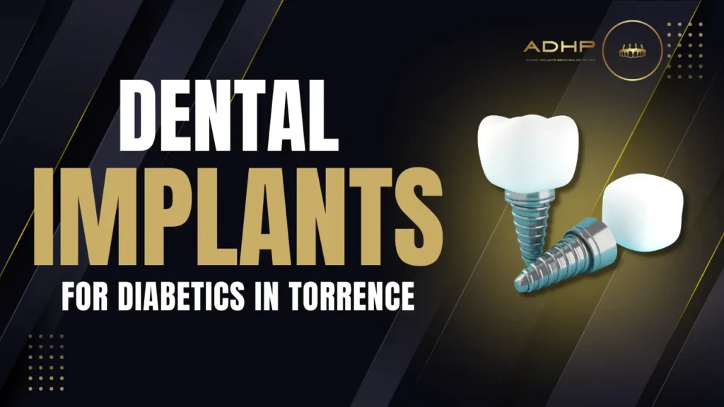 Dental Implants for Diabetics in Torrance