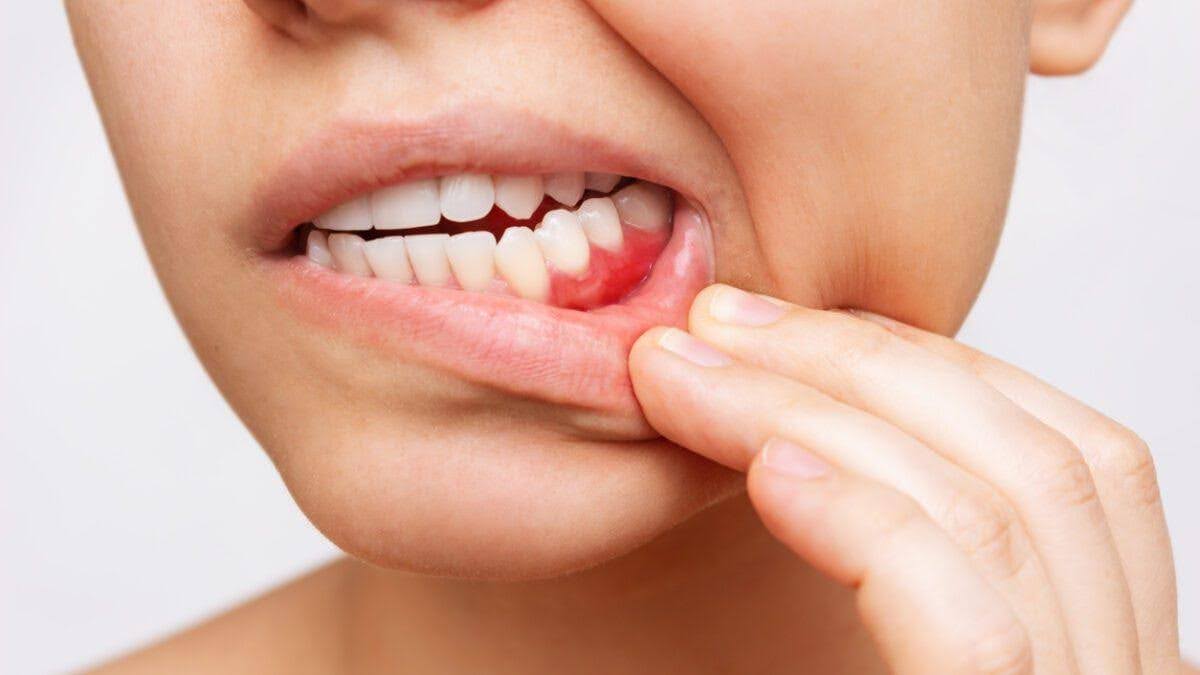 Infection or Abscess