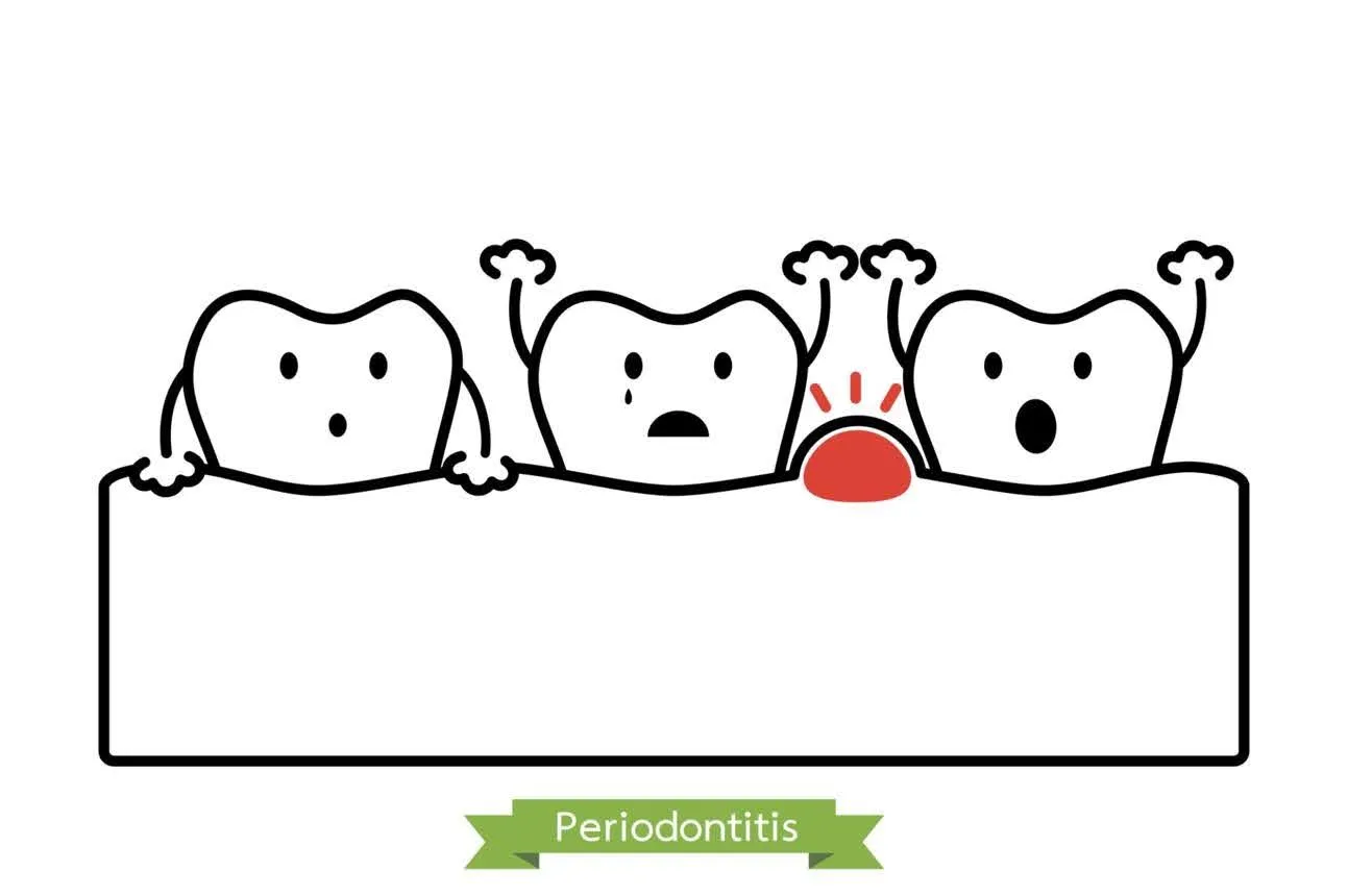 periodontitis