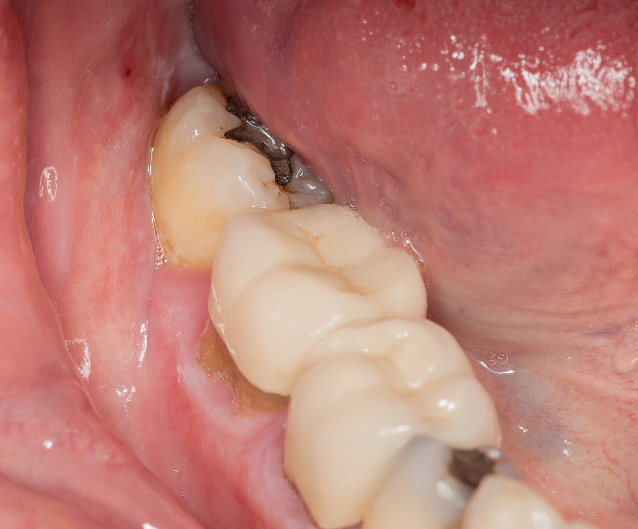 close-up-macro-shot-of-interior-of-mouth-and-filli