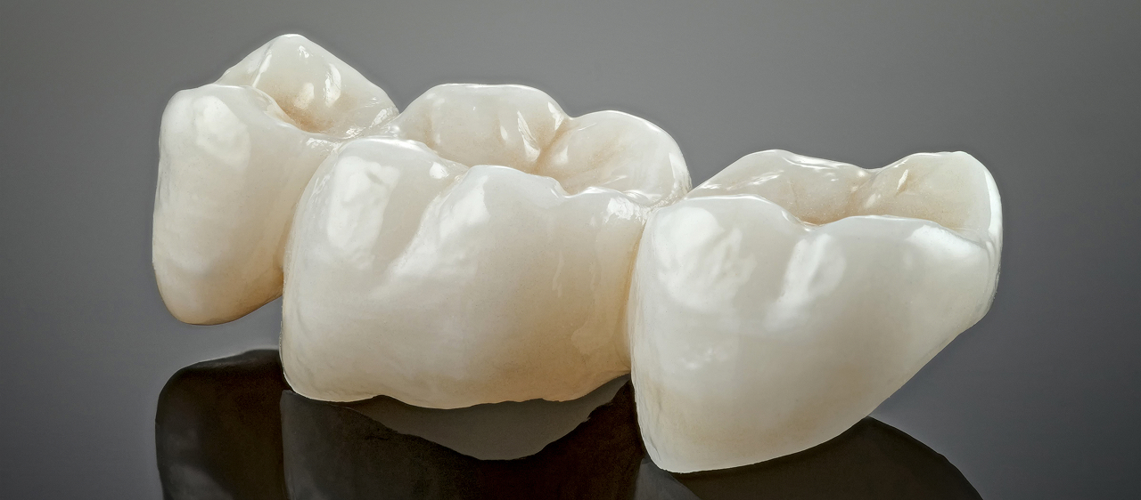 dental-bridge-close-up-on-grey-background-2026-03-17-17-45-26-utc 1