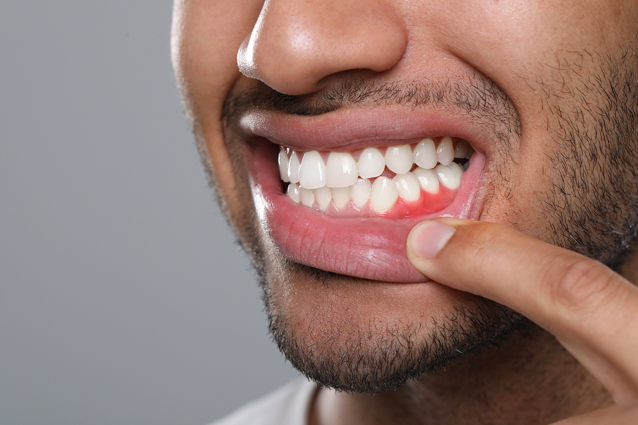 extreme-close-up-of-man-with-inflamed-gums-and-gin
